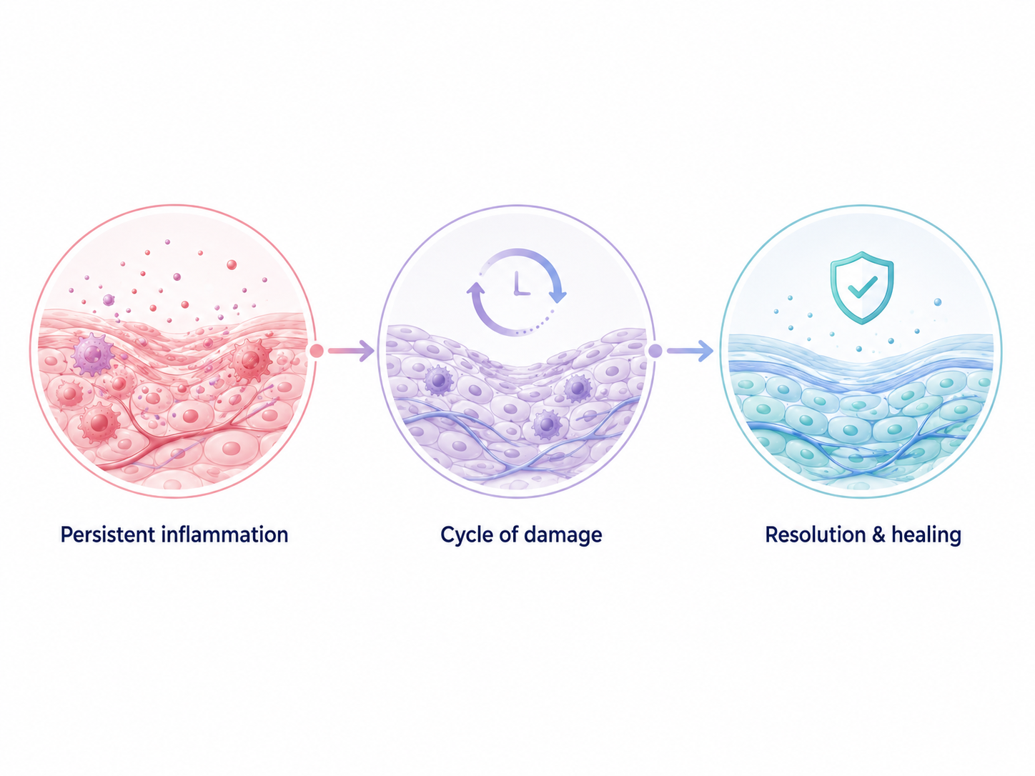 Three-step scientific infographic showing persistent inflammation progressing into a cycle of tissue damage, followed by resolution and healing, using circular tissue illustrations connected by arrows.